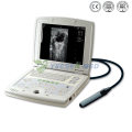 Ysb5000 Medical Full Digital Scanner à ultrasons portable